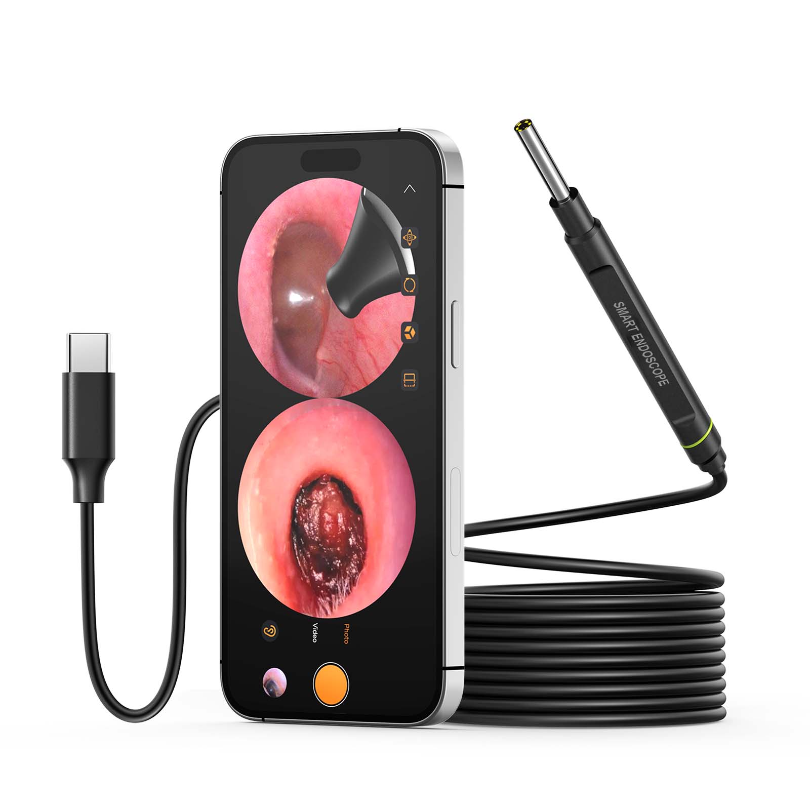 SMART ENDOSCOPE USB Digital Otoscope with Camera